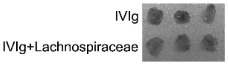 Combination medicine of hispiraceae bacteria and human immune globulin for injection