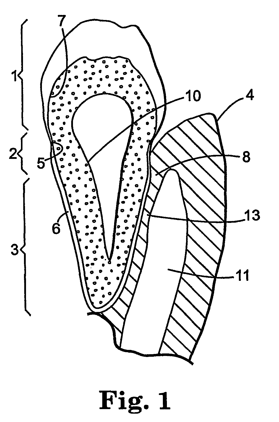 Methods for the treatment of periodontal disease