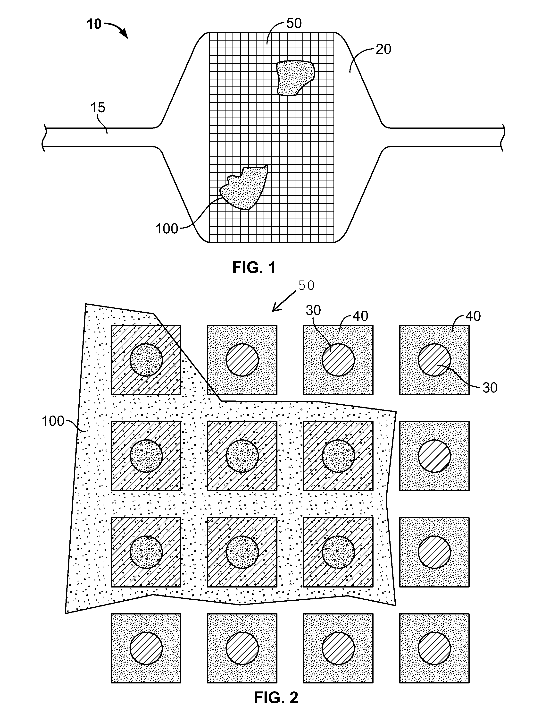 Delivery device for localized delivery of a therapeutic agent