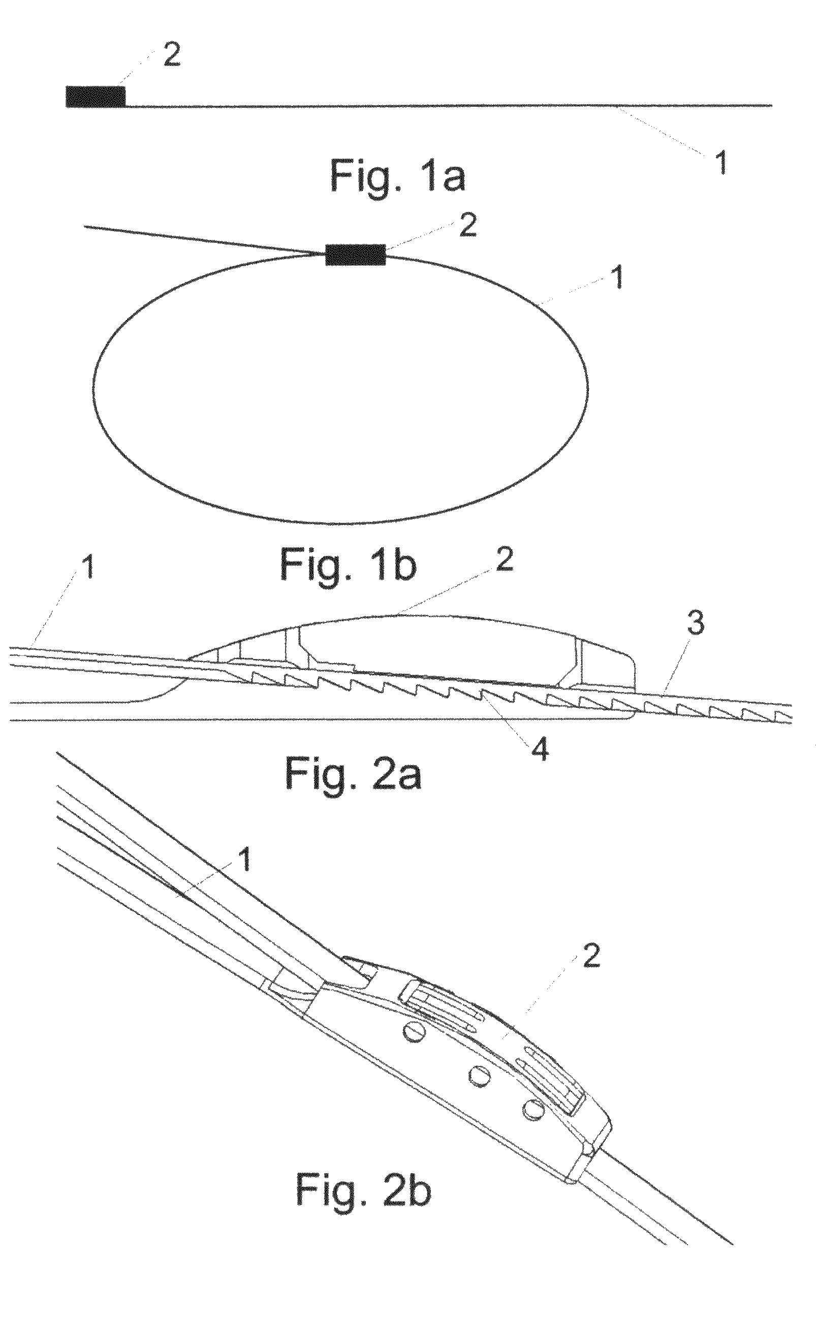 Bioabsorbable band system, a bioabsorbable band, a method for producing a bioabsorbable band, a needle system of a bioabsorbable band and a locking mechanism
