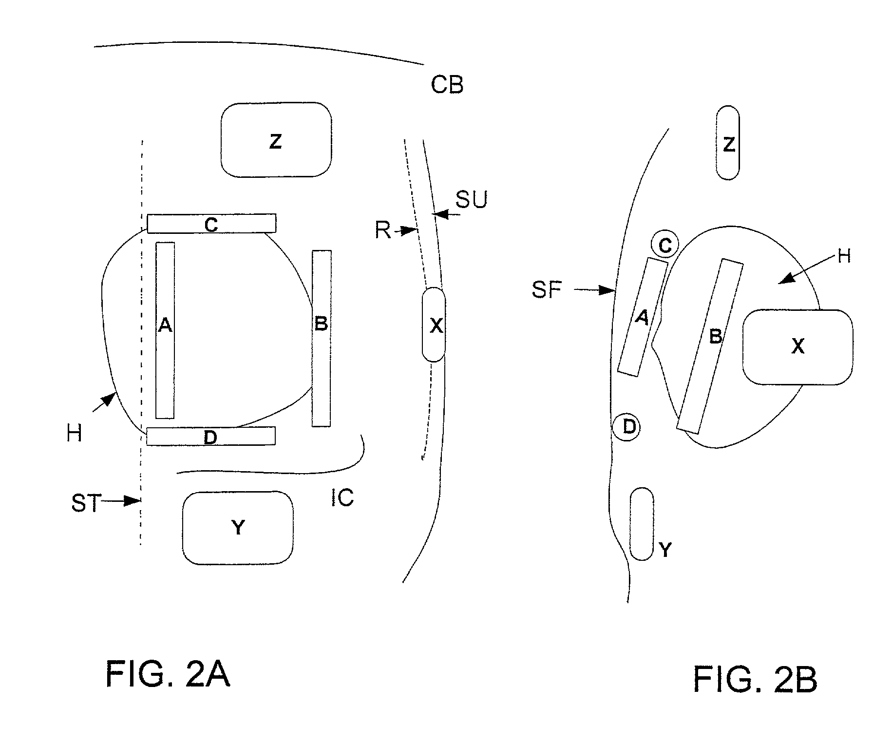 Subcutaneous cardiac stimulator device having an anteriorly positioned electrode