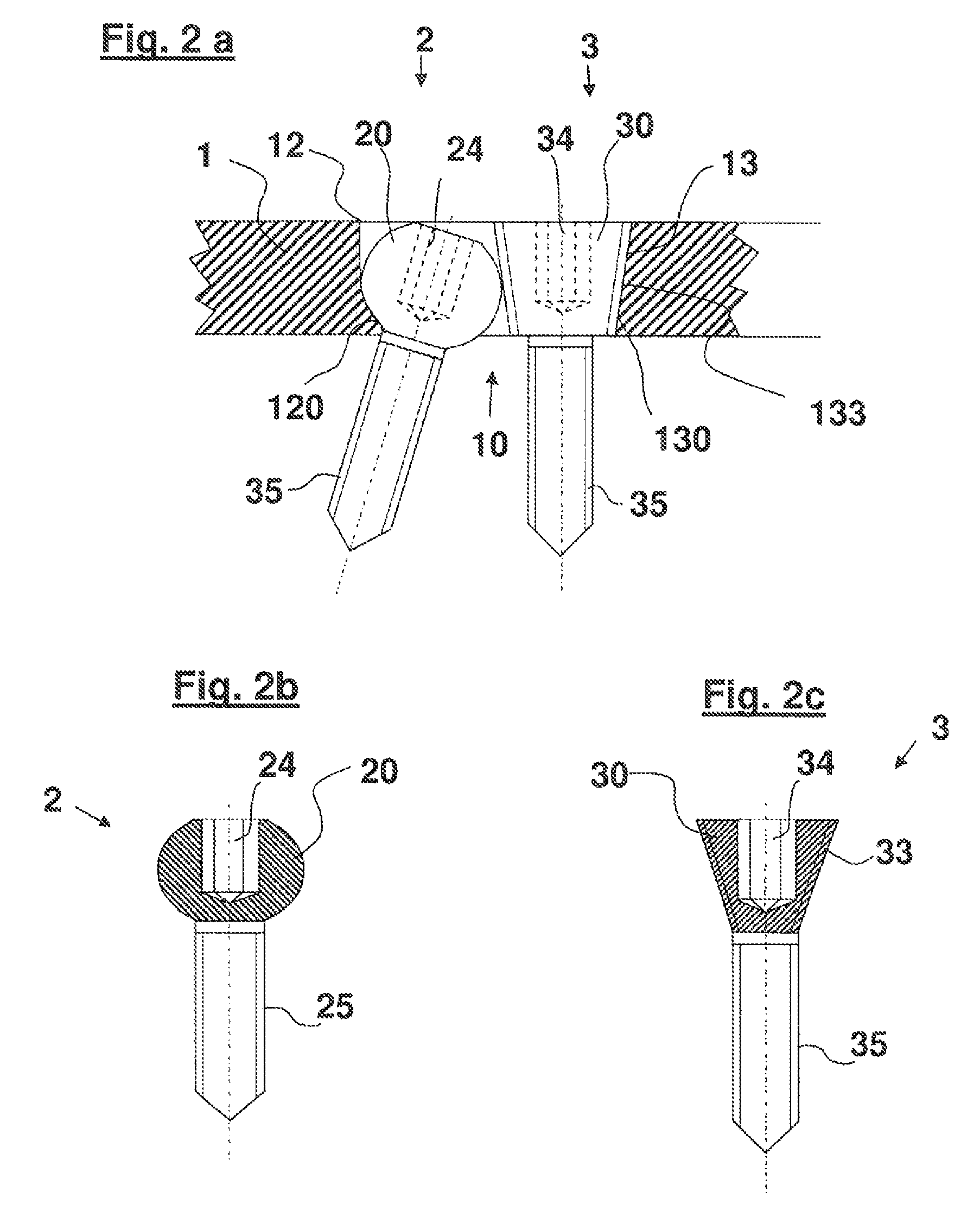 Bone plate system for osteosynthesis