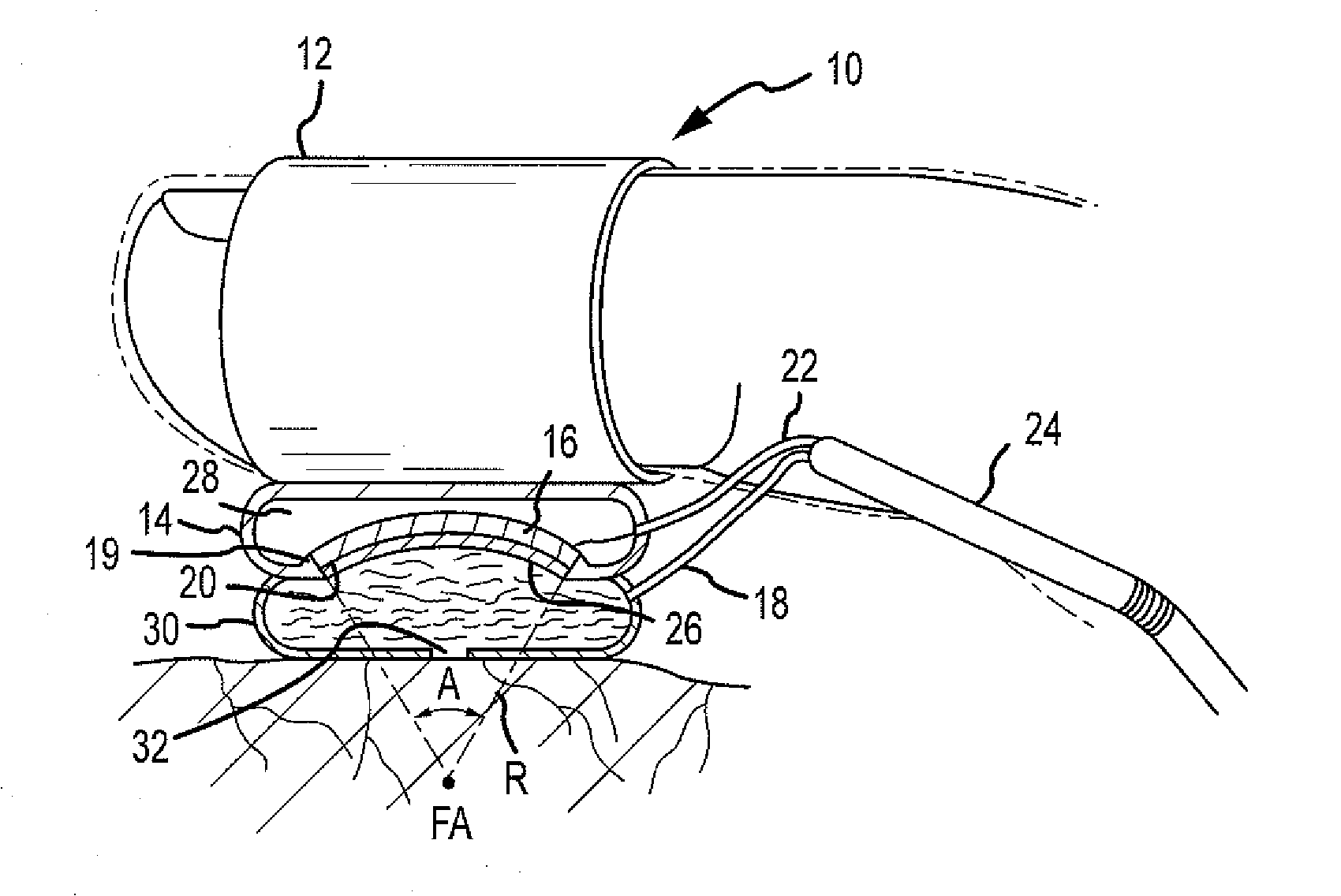 Finger-mounted or robot-mounted transducer device