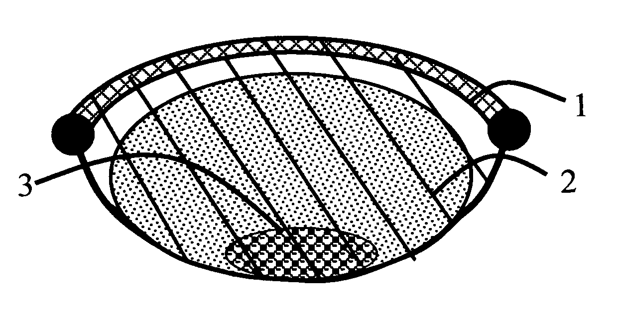 Pap sphere cervical and endocervical cell home collection device