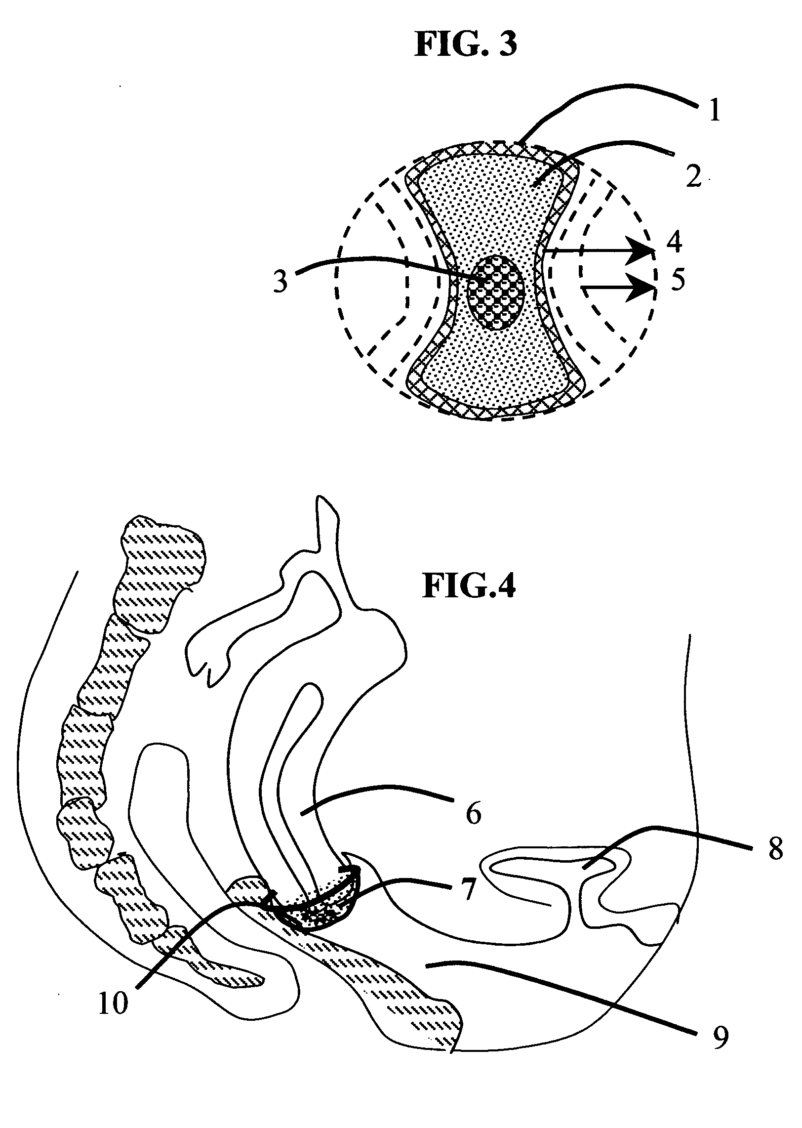 Pap sphere cervical and endocervical cell home collection device