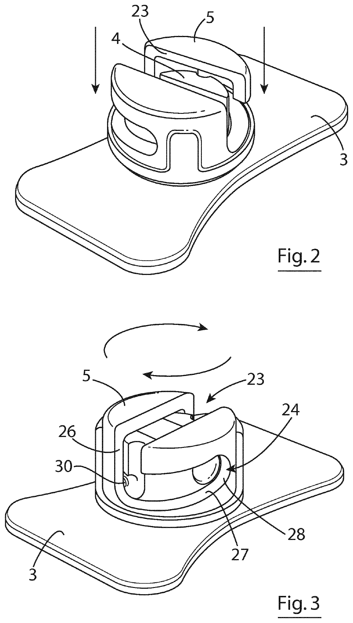 Securement device for pipes, cables or catheters