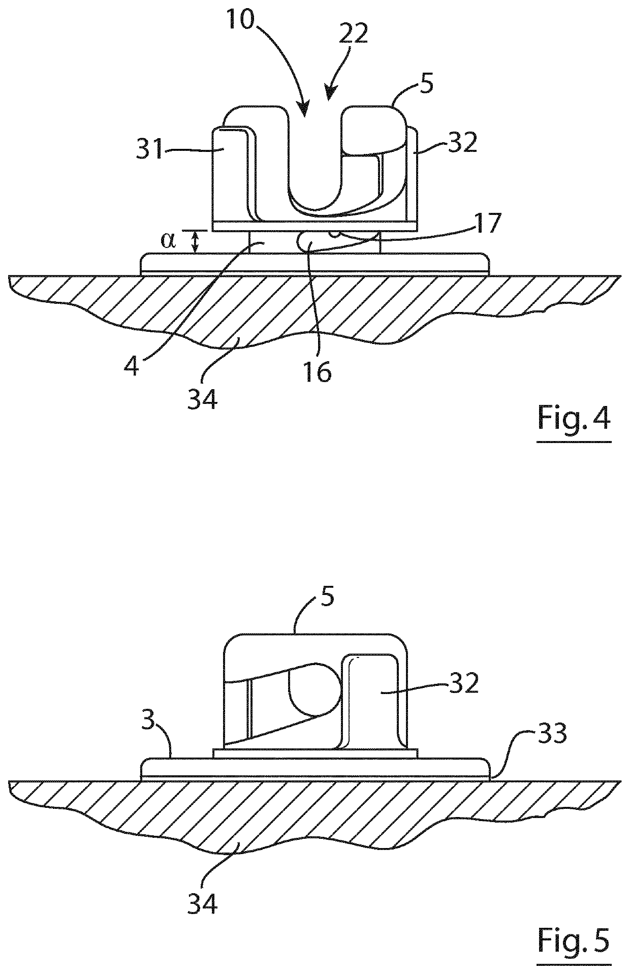 Securement device for pipes, cables or catheters