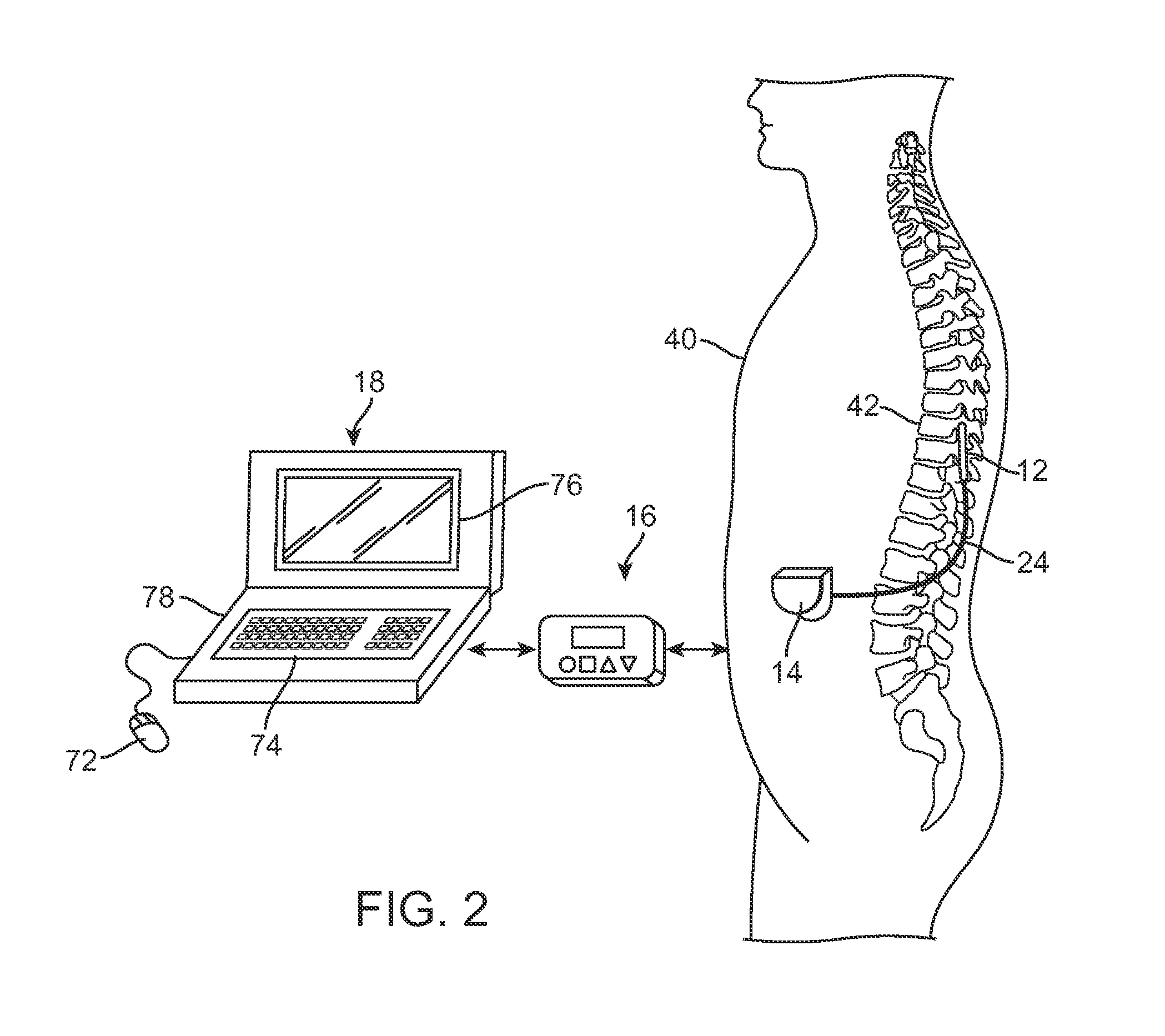 System and method for determining appropriate steering tables for distributing stimulation energy among multiple neurostimulation electrodes