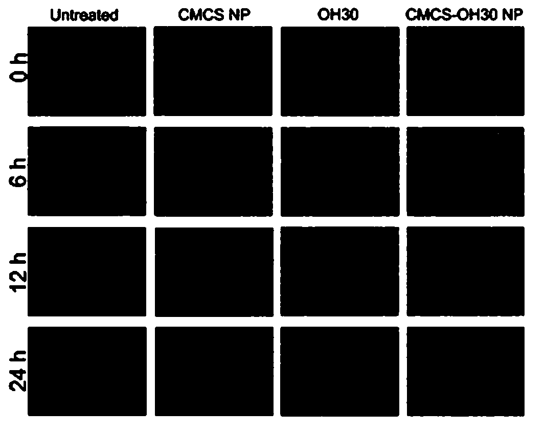 Reptile antibacterial peptide OH-CATH30 nanometer granules and nanofibers and application of nanofibers