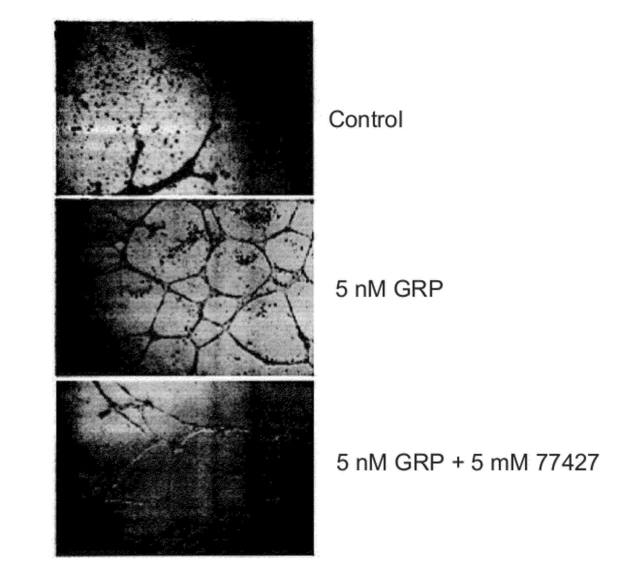 Non-peptide antagonists of gastrin releasing peptide