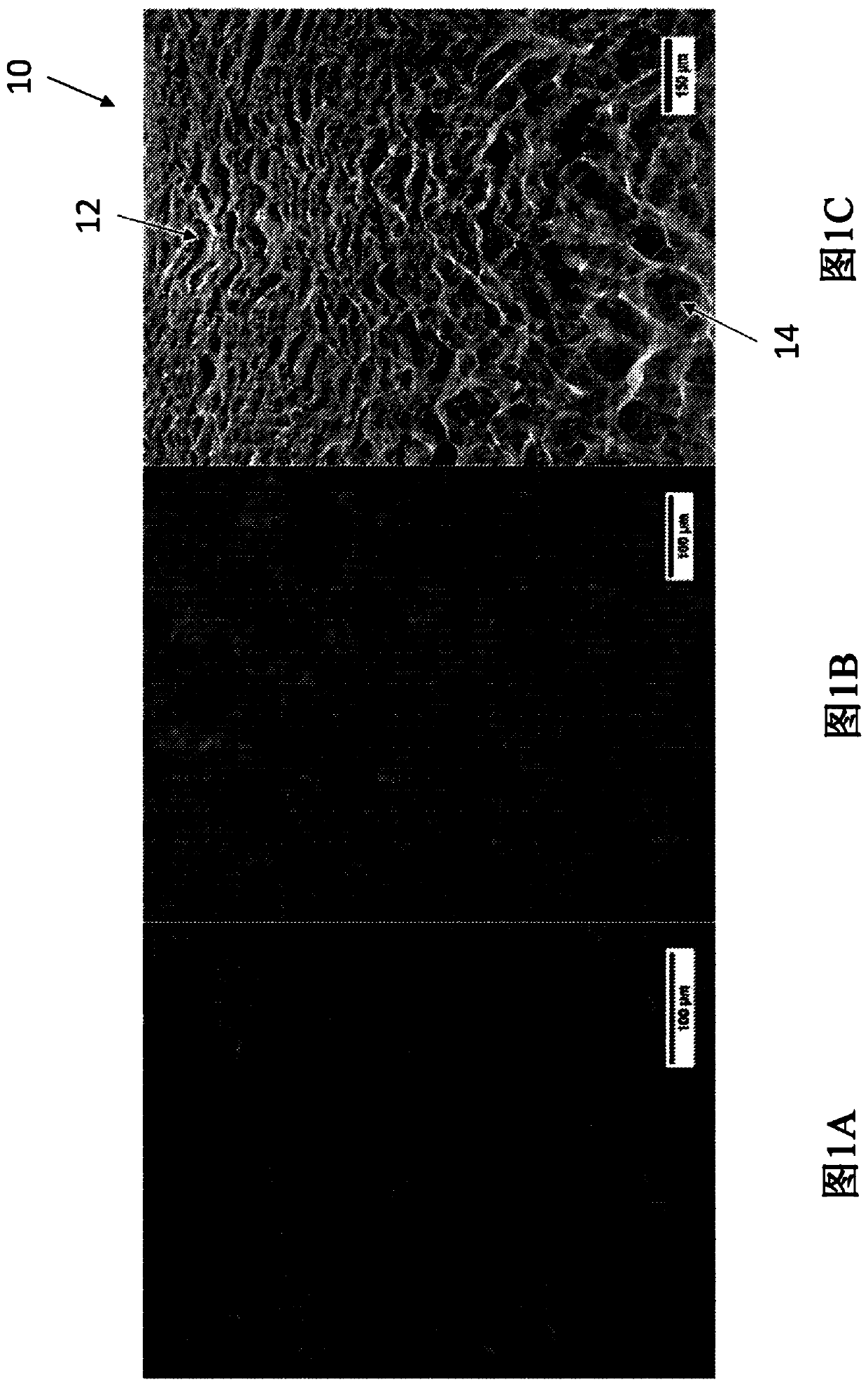 Graded porous scaffolds as immunomodulatory wound patches