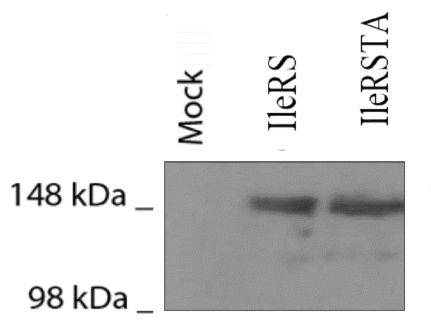 Screening method for identifying new aminoacyl-tRNA synthetase inhibitors