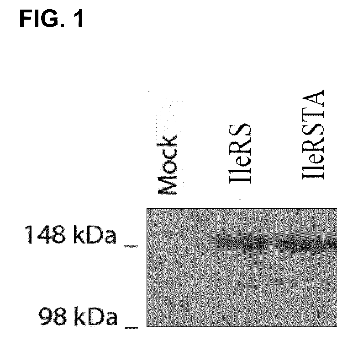 Screening method for identifying new aminoacyl-tRNA synthetase inhibitors