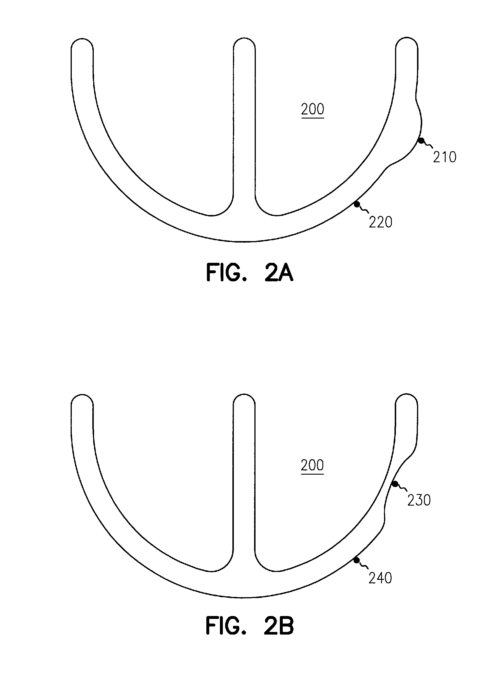 Apparatus and method for reversal of myocardial remodeling with electrical stimulation