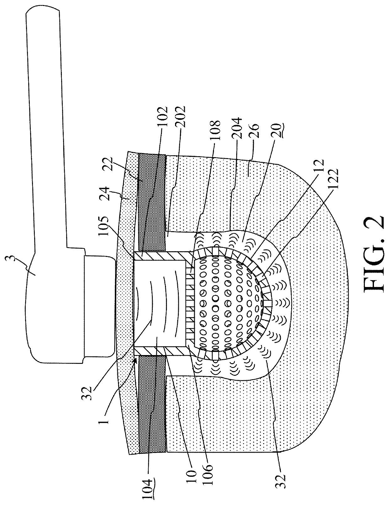 Implantable ultrasound conducting and drug delivering apparatus
