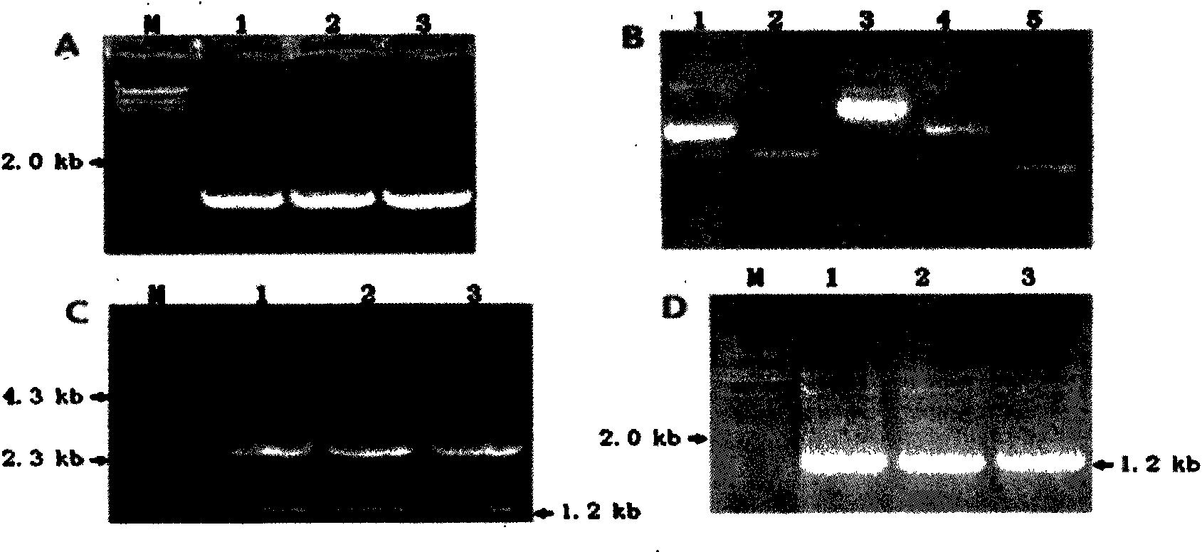 Plant expression vector for improving capability of assimilating and formaldehyde absorption of plant and application thereof