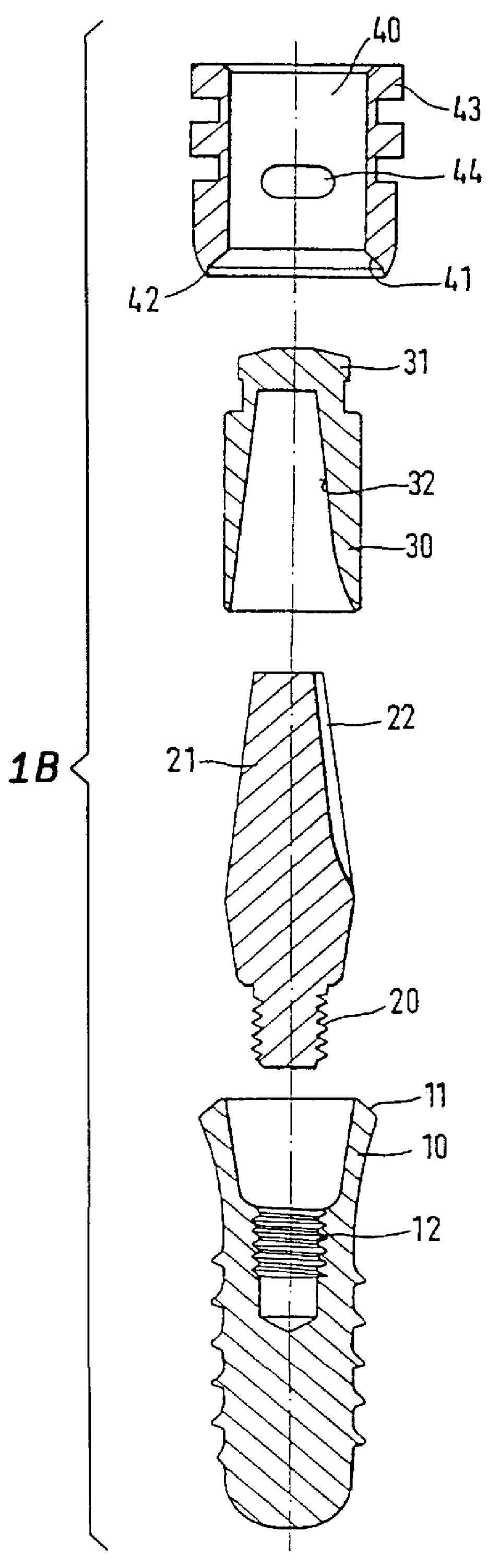Impression system for an end of an implant projecting from a human tissue structure