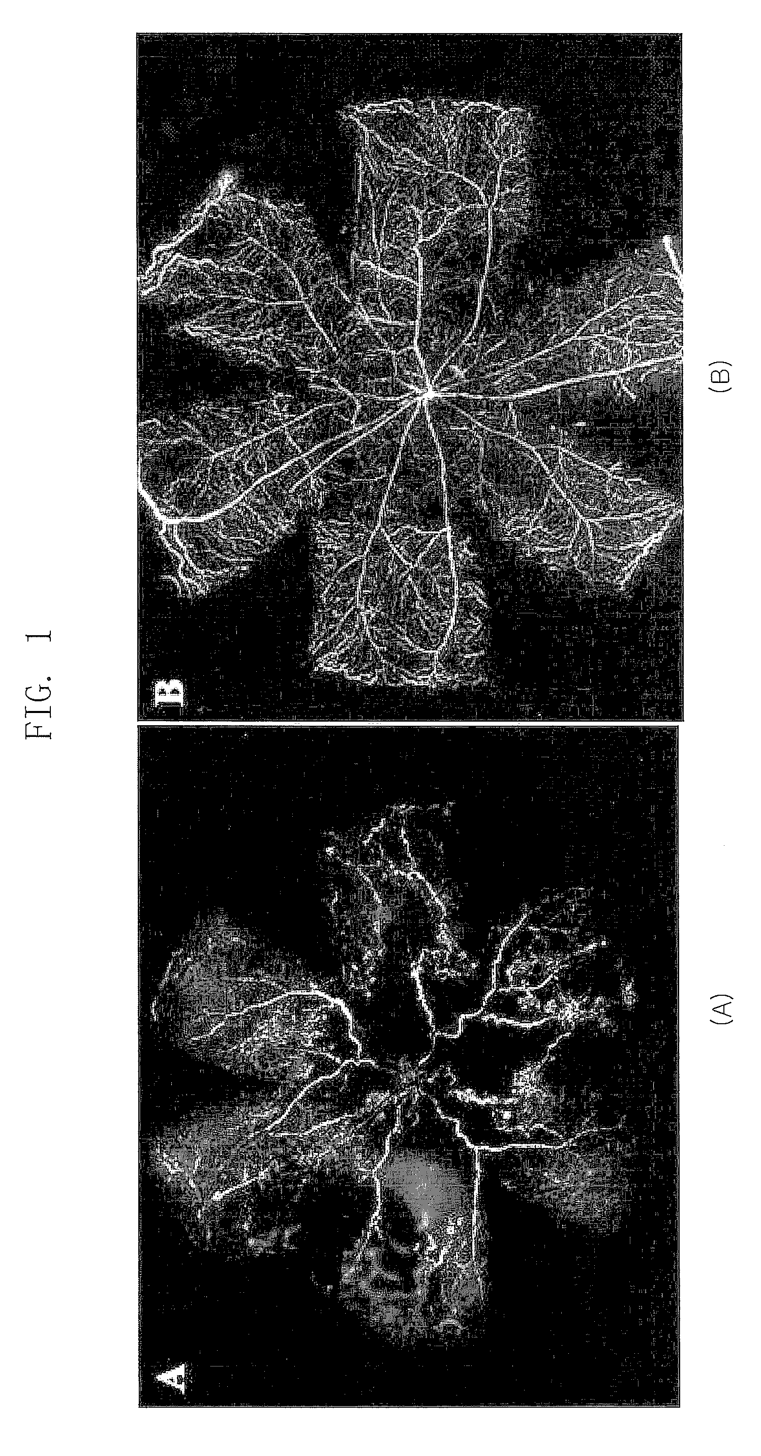 Composition for treating retinopathy or glaucoma comprising thrombin derived peptides