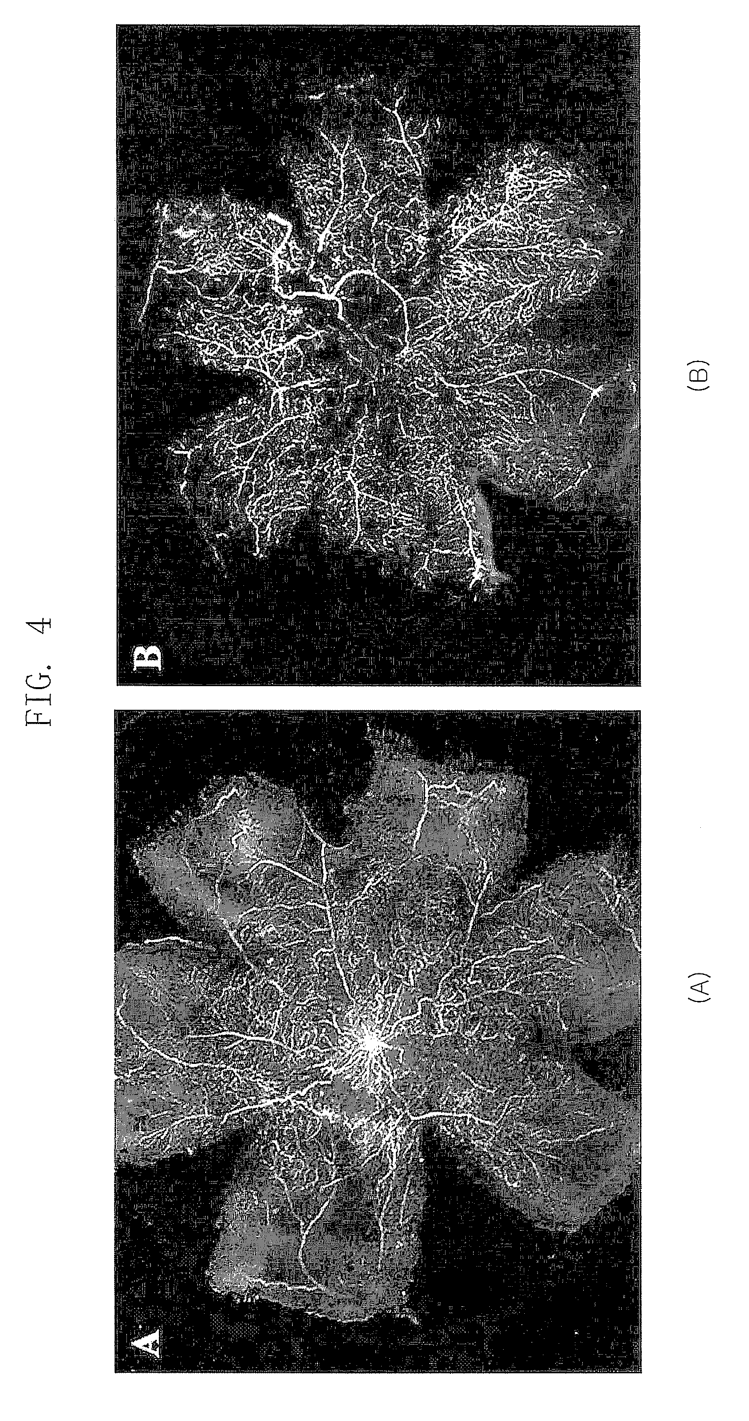 Composition for treating retinopathy or glaucoma comprising thrombin derived peptides
