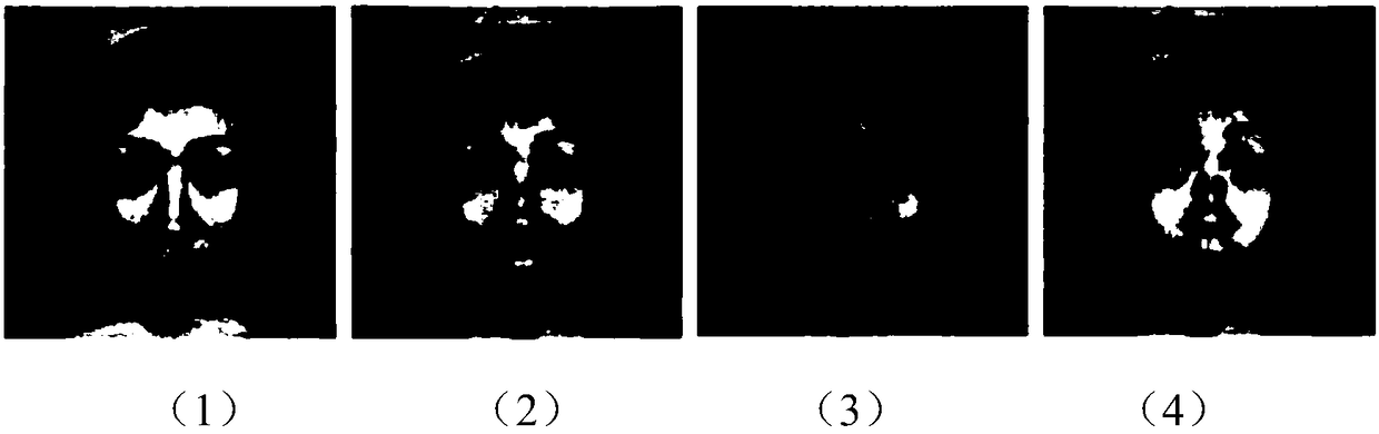 An intelligent terminal face unlocking method combined with expression recognition