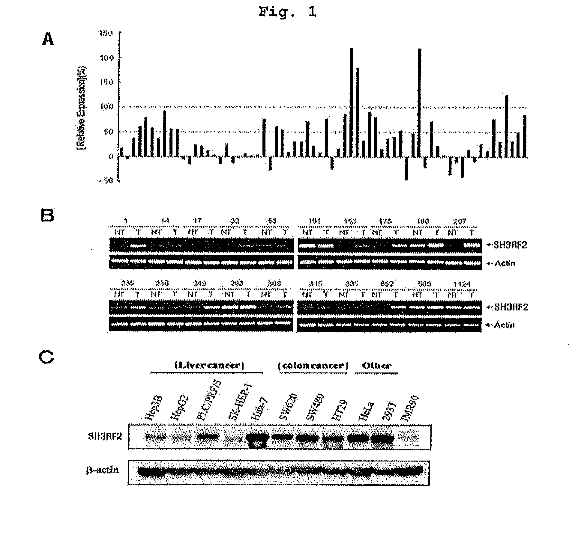 Composition Containing Inhibitors of the Expression or Activity of SH3RF2 for Preventing or Treating Cancer