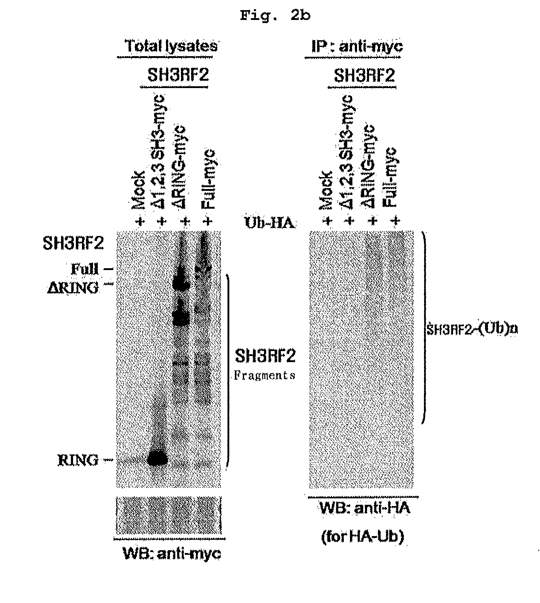 Composition Containing Inhibitors of the Expression or Activity of SH3RF2 for Preventing or Treating Cancer