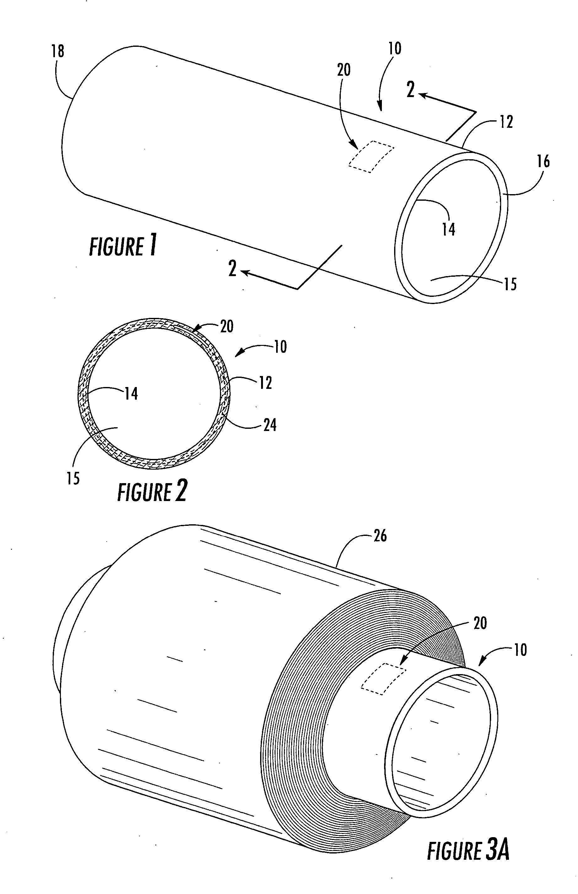 Identification device for multilayer tubular structures