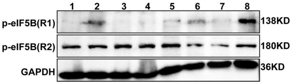 A kind of phosphorylated eif5b specific antibody and its preparation method and application