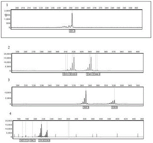 Microsatellite marker relevant with tachysurus fulvidraco growth characteristics and detection and application thereof