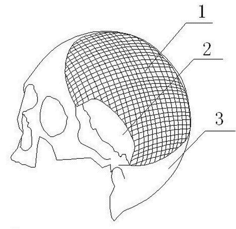 Craniocerebral three-dimensional forming restoration with muscle base window and preparation method thereof