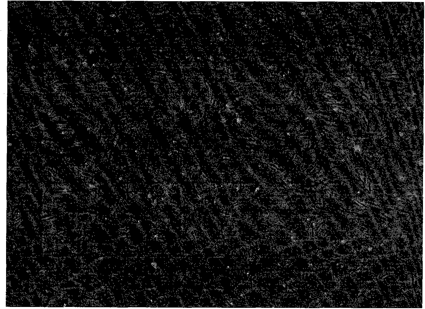 Method for isolating and culturing human olfactory mucosa mesenchymal stem cells