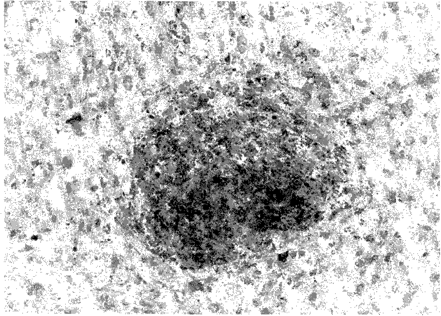 Method for isolating and culturing human olfactory mucosa mesenchymal stem cells