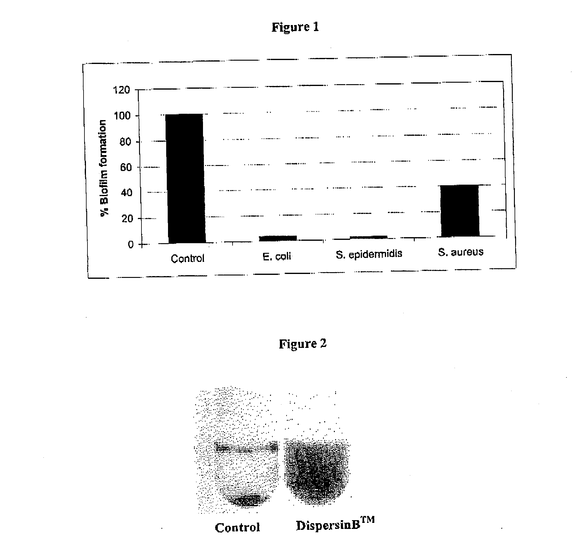 Souluble b-n-acetylglucoseaminidase based antibiofilm compositions and uses thereof