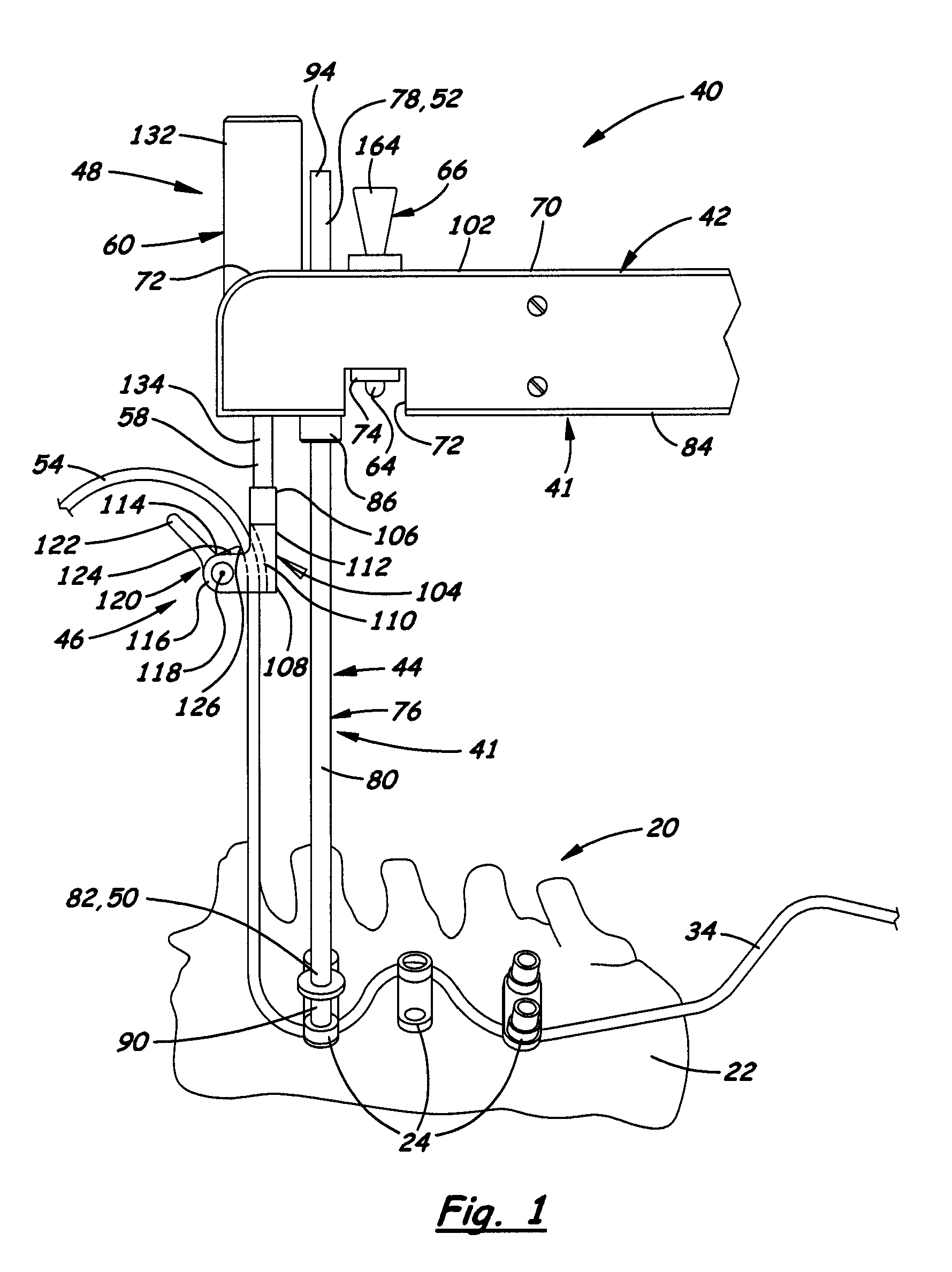 Apparatus and method for applying sustained tension on a tether