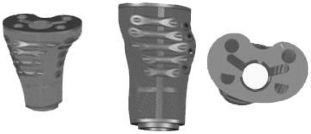 Manufacturing method of personalized knee bionic prosthesis based on 3D printing
