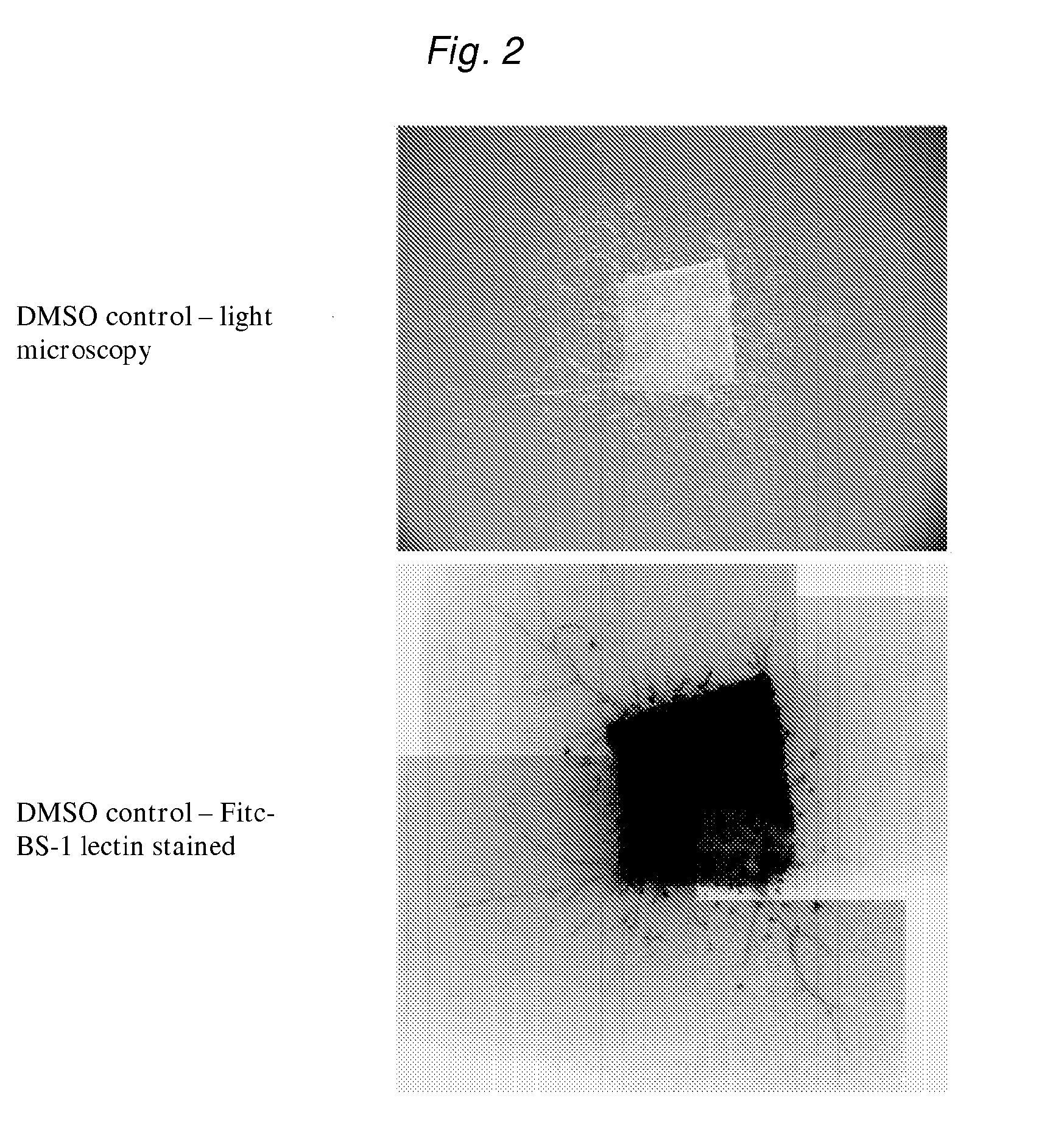 Methods and compositions for inhibiting angiogenesis