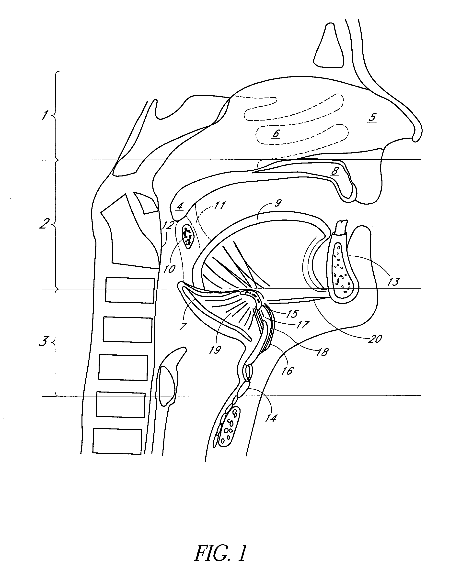 Glossal engagement system and method