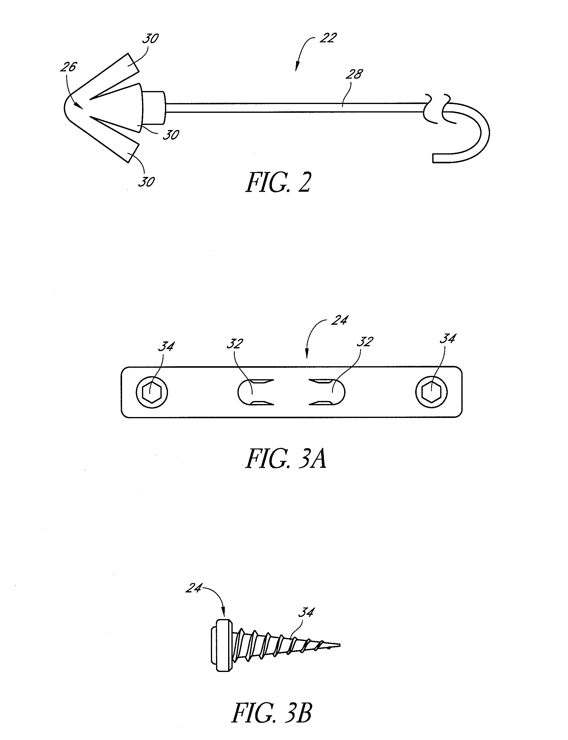 Glossal engagement system and method