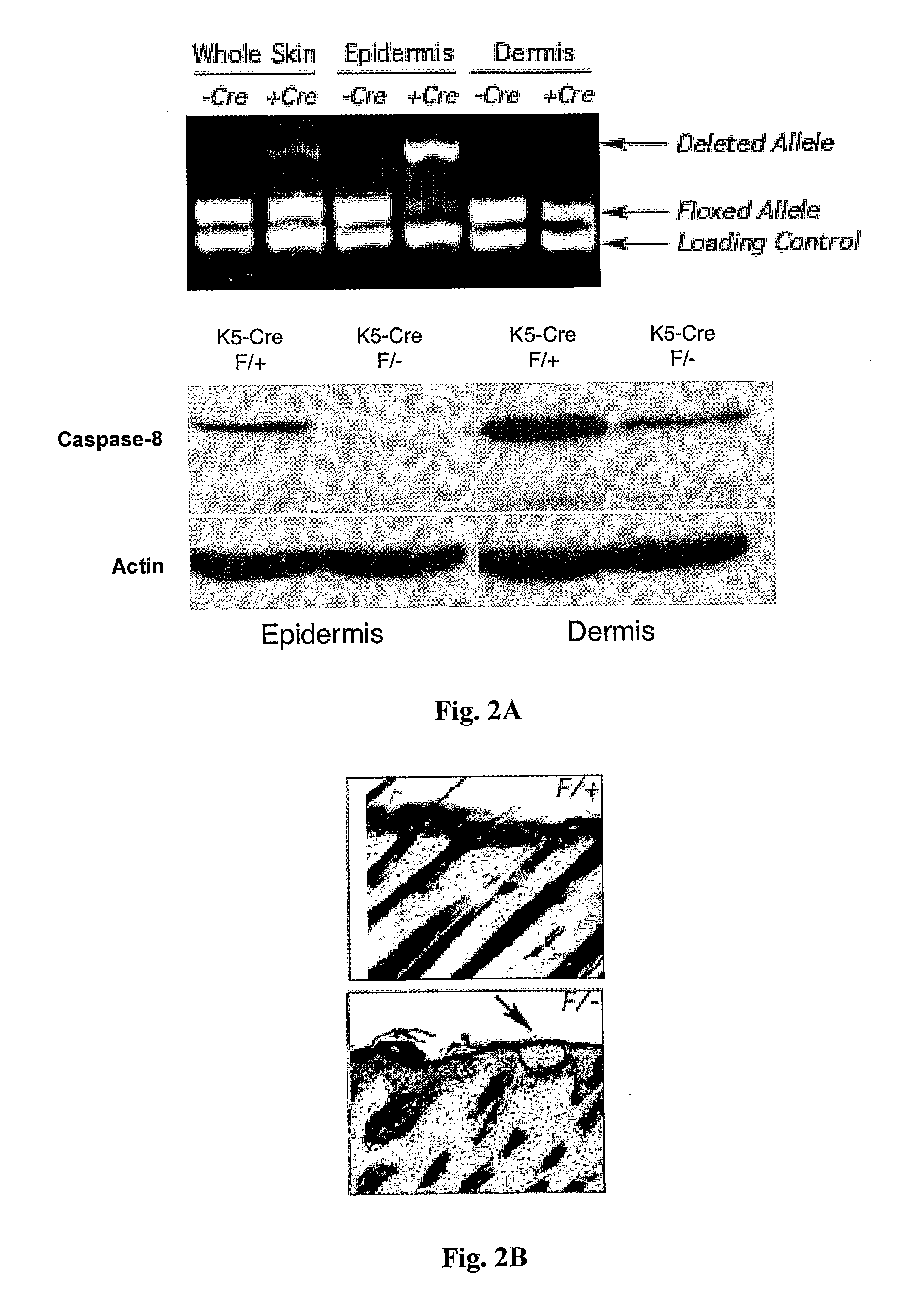 Caspase-8 and skin disease