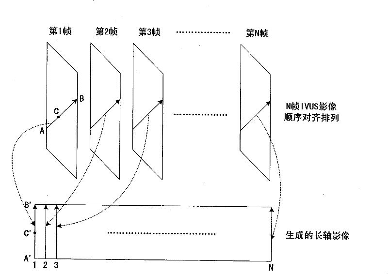 Method for structuring ultrasound long axis image quickly with high fidelity