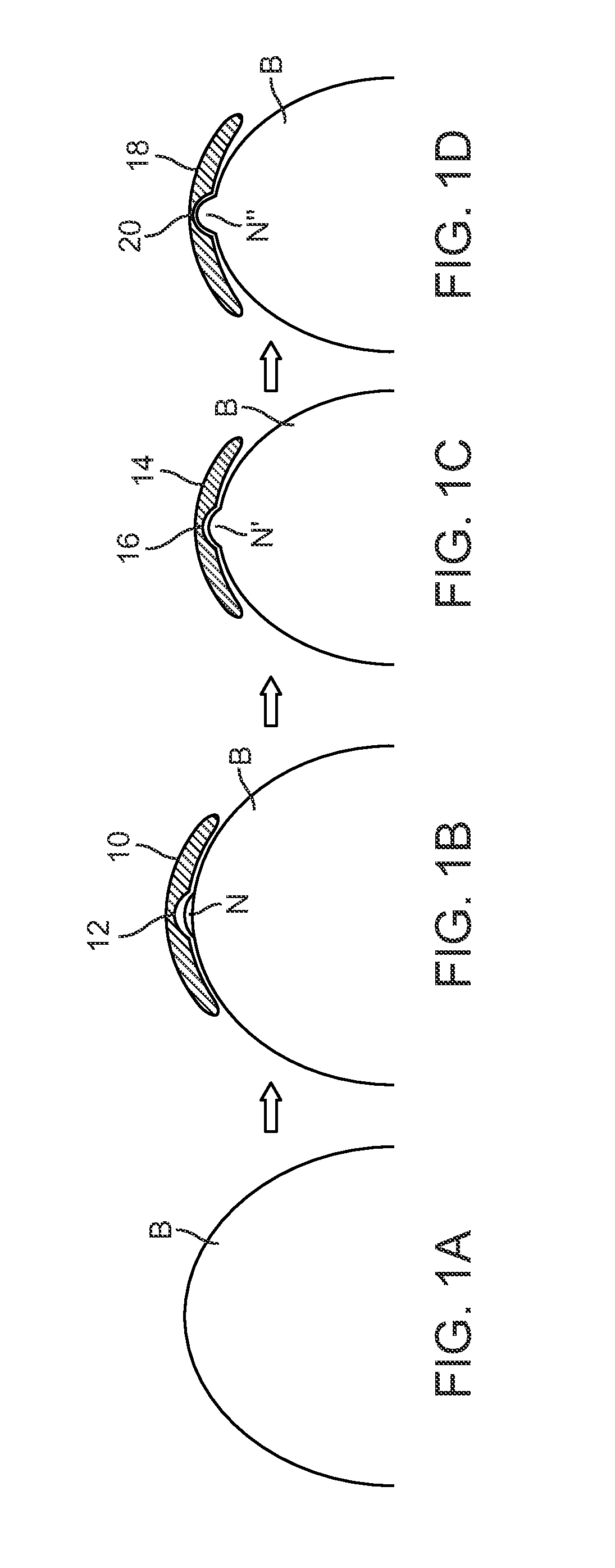 Apparatus and methods for nipple and breast formation