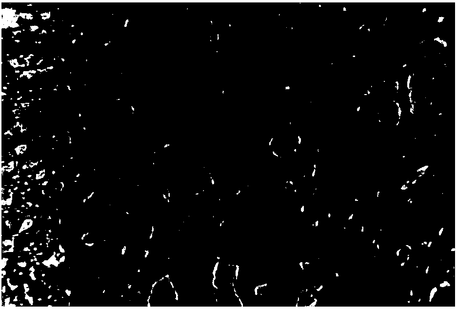 Acellular vascular matrix material preparation method