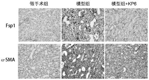 Application of small molecule polypeptide kp-6 in preparing medicine for treating chronic kidney disease