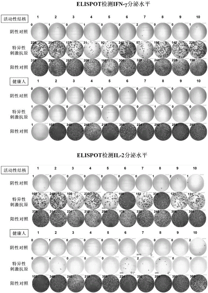 In-vitro abortive phthisic test method