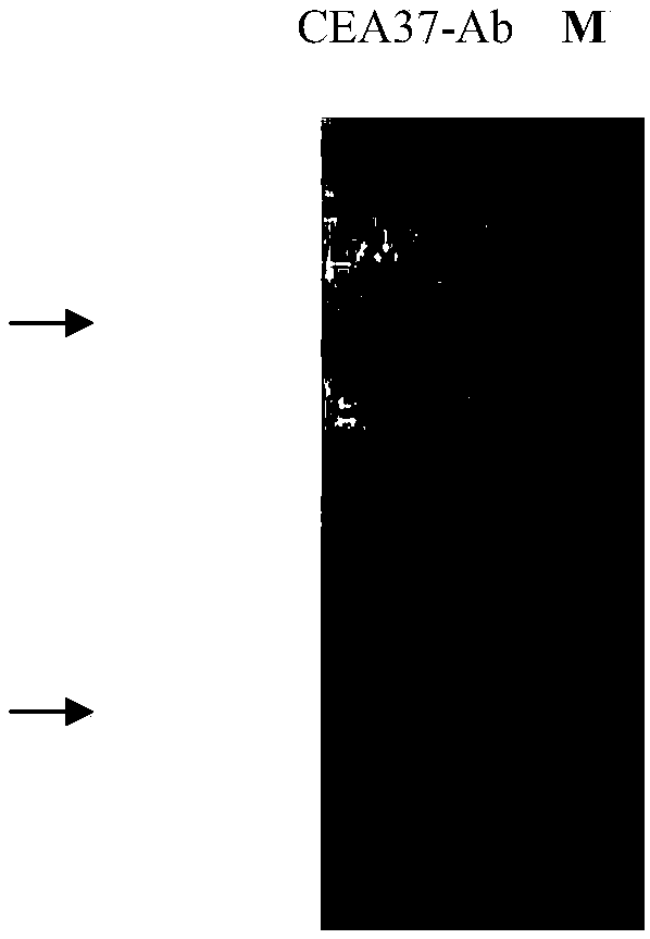 Anti-MG7-Ag monoclonal antibody of and application thereof