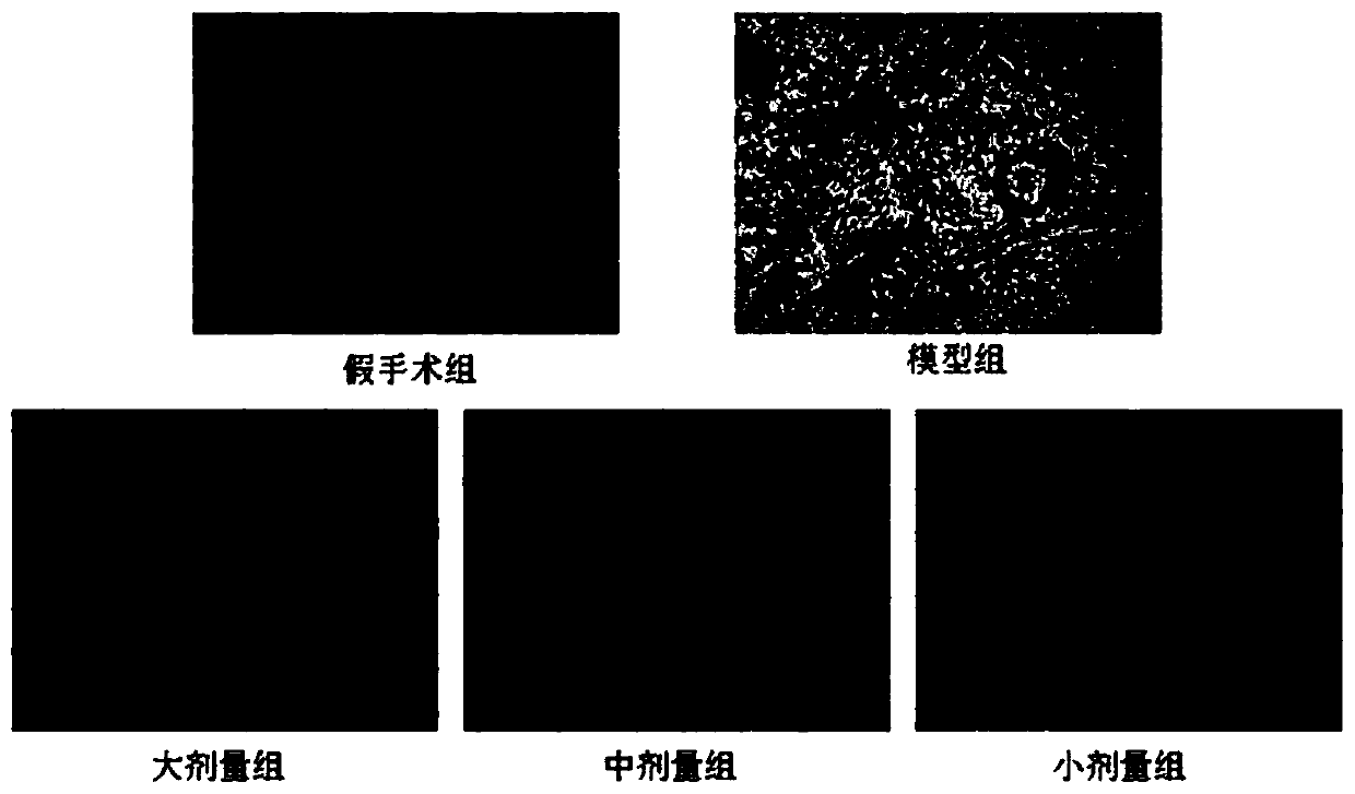 Application of basil polysaccharide extract in preparation of medicine for treating pulmonary fibrosis