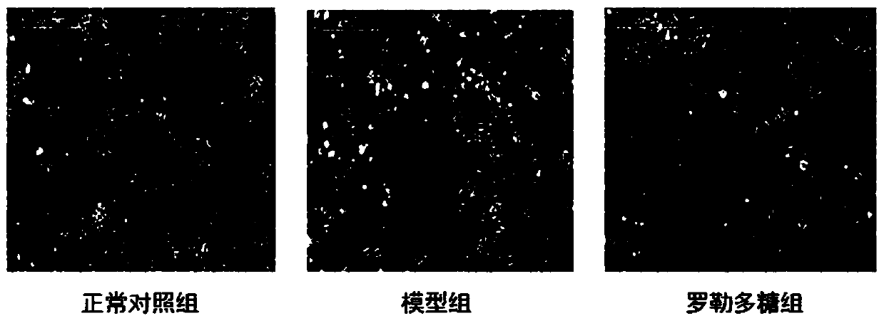 Application of basil polysaccharide extract in preparation of medicine for treating pulmonary fibrosis