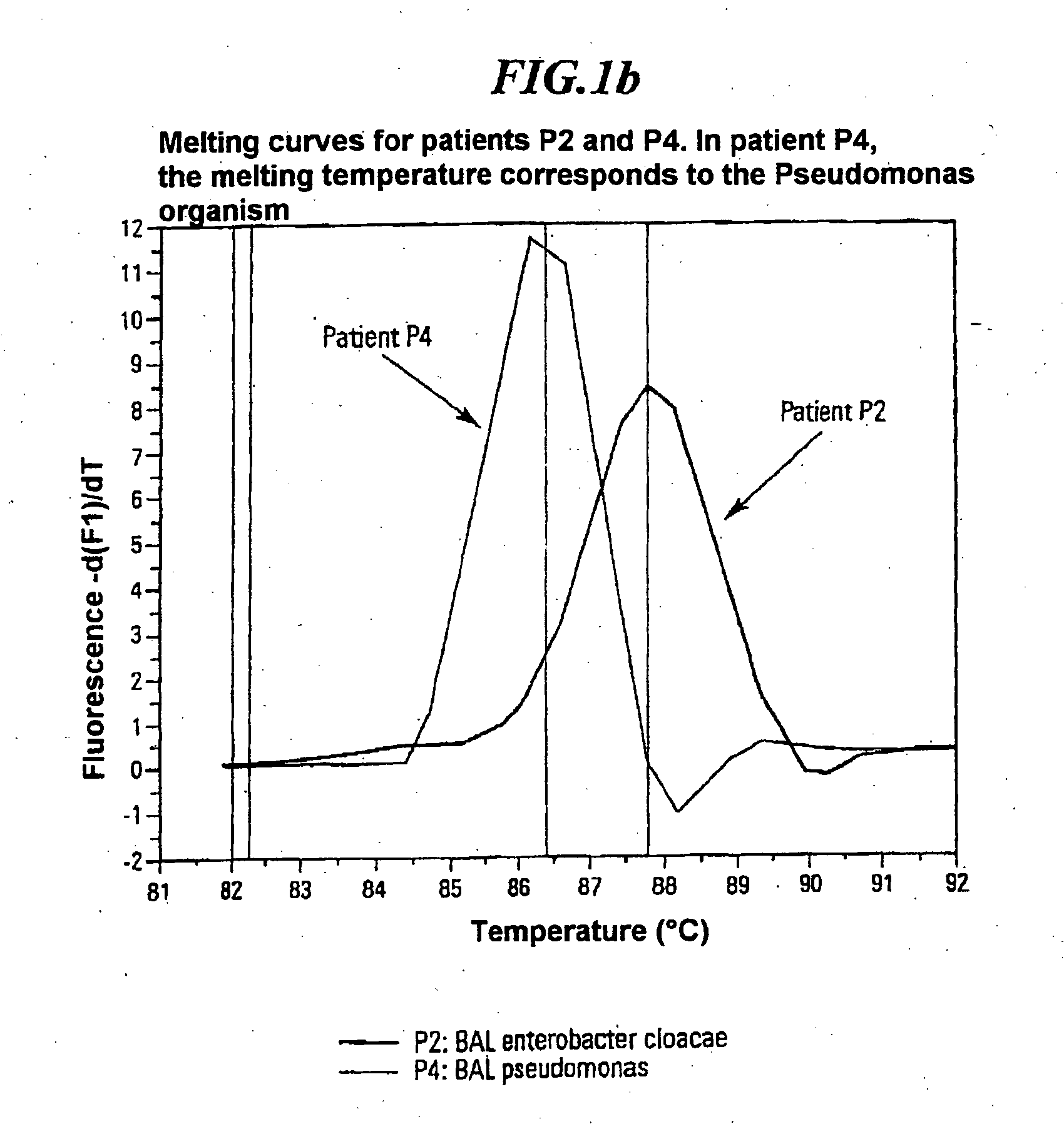 Method for quickly detecting microbial dna/rna, kit therefor and the use of said method