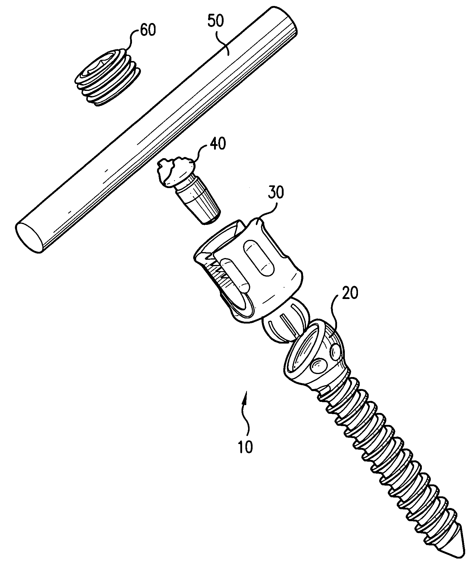 Biased angle polyaxial pedicle screw assembly