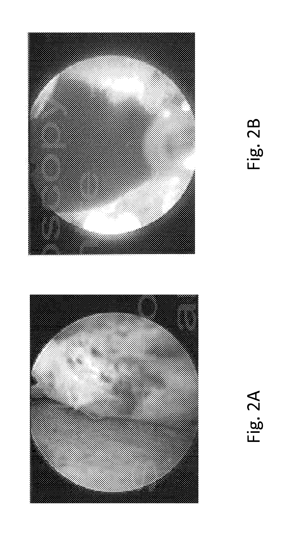 Laser systems and methods for vaporization of prostate and other tissue